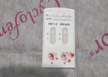 Hidalgo avanza en prevención y tratamiento del VIH