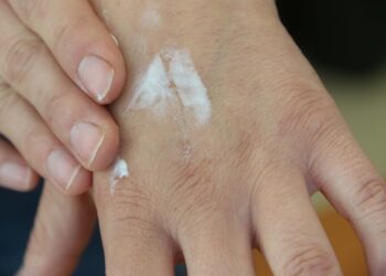 Advierten sobre riesgo por exposición a radiación solar