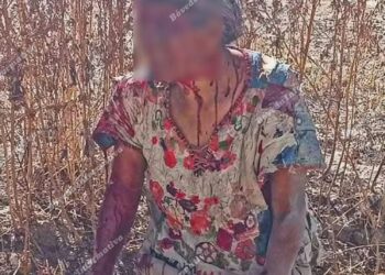 Mujer de la tercera edad gravemente herida tras ataque de jauría en Tizayuca