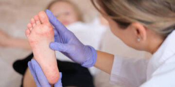 Pide la Secretaría de Salud reforzar las medidas preventivas ante casos de Coxsackie