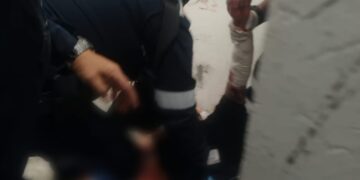 De agresor a lesionado: hombre se hiere gravemente dentro de barandilla municipal